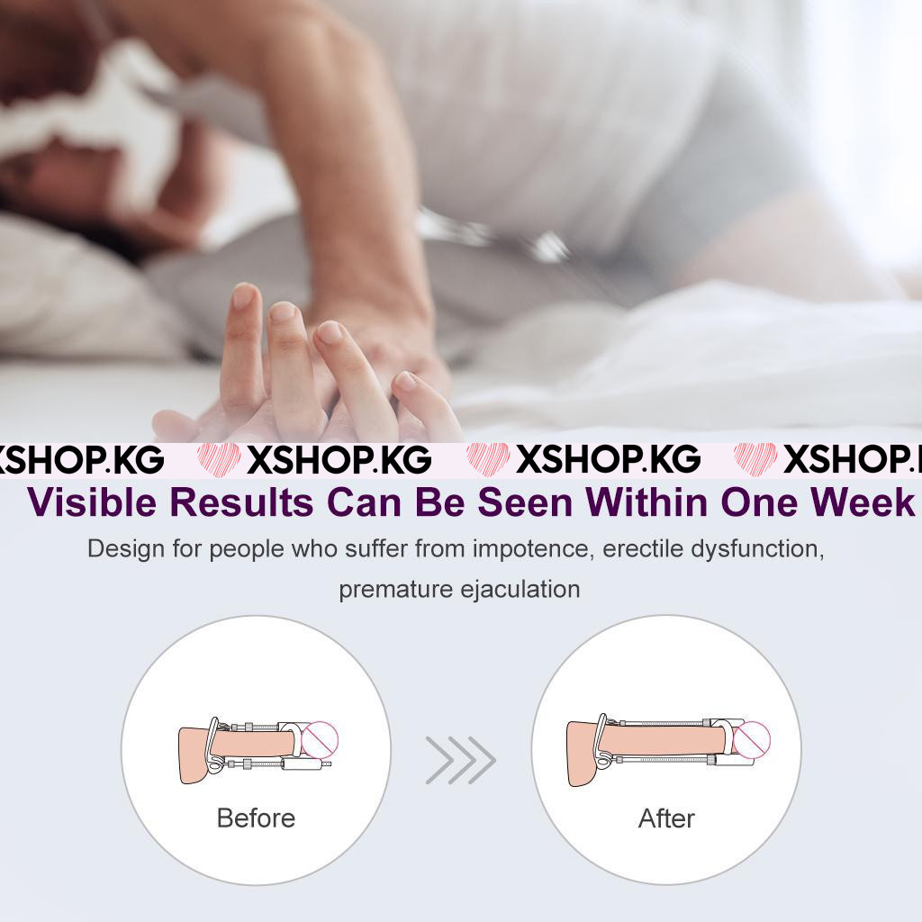 "Penis Extender" для увеличения члена